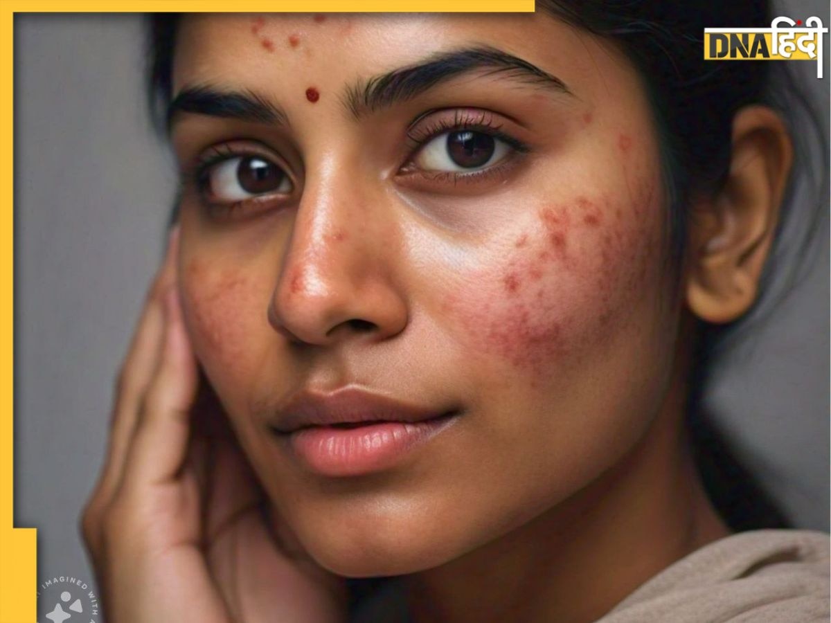 Skin से जुड़ी समस्याओं में दवा का काम करते हैं ये पत्ते, बस जान लें इस्तेमाल का सही तरीका