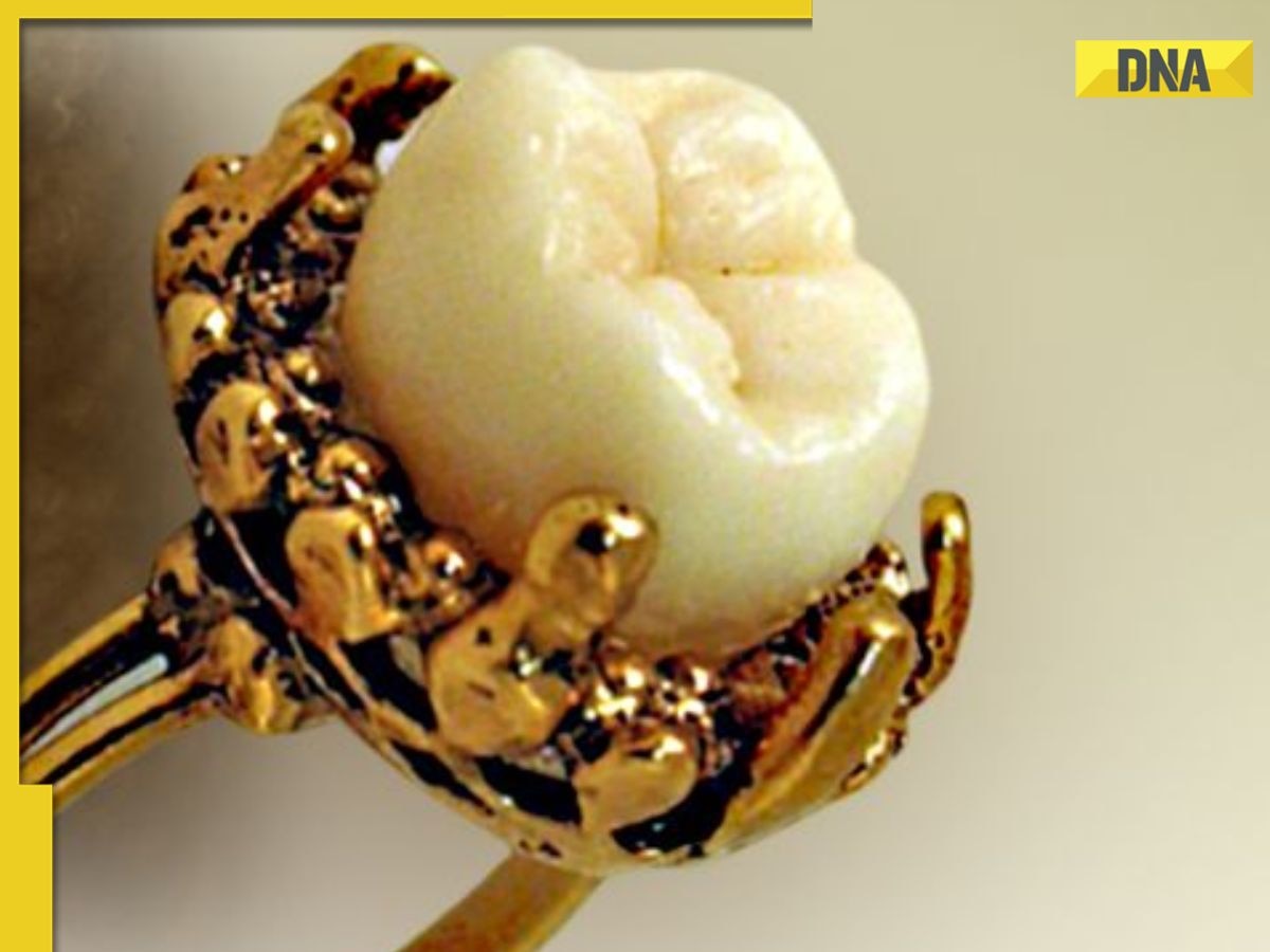 World’s most expensive human tooth is valued over Rs 3000000, it belonged to…