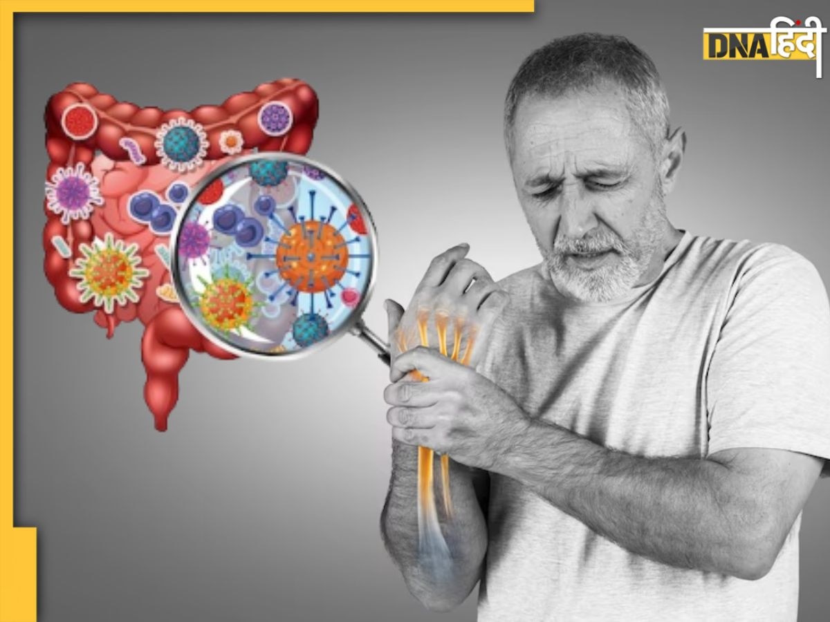 रिसर्च में खुलासा, Rheumatoid Arthritis का जोखिम बढ़ाती है आंत में होने वाली ये समस्या