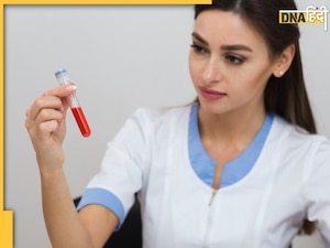 शरीर में हो गई है प्लेटलेट्स की कमी? डाइट में शामिल करें ये चीजें