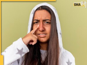  ​​​​​​​आंखों के नीचें बढ़ गए हैं Dark Circles, छुटकारा पाने के लिए फॉलो करें ये 7 टिप्स