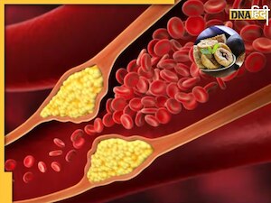 शरीर से Bad Cholesterol को खींच निकालेगा ये सूखा फल, जान लें सेवन का सही तरीका