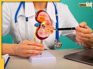 हाथ-पैर में है सूजन? हो सकता है स्टेज-2 Kidney की बीमारी का संकेत, तुरंत दें इन बातों पर ध्यान