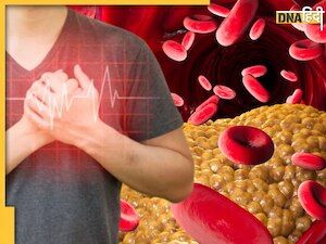 ठंड में तेजी से बढ़ सकता है Bad Cholesterol, बचने के लिए इन 5 चीजों से बनाएं दूरी