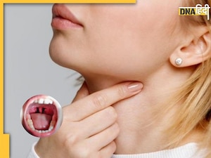टॉन्सिल की वजह से होती है दर्द व सूजन की समस्या, इन 5 देसी नुस्खों से दूर होगी परेशानी