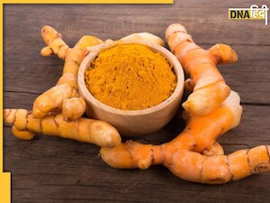 Raw Turmeric Benefits: यूरिक एसिड से लेकर दाग-धब्बे तक, कच्ची हल्दी के ये फायदे जानकर हैरान रह जाएंगे आप