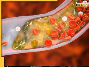 Cholesterol Control: रोज सुबह खाली पेट खाएं ये चीज, गंदा कोलेस्ट्रॉल नसों से निकल कर आएगा शरीर से बाहर
