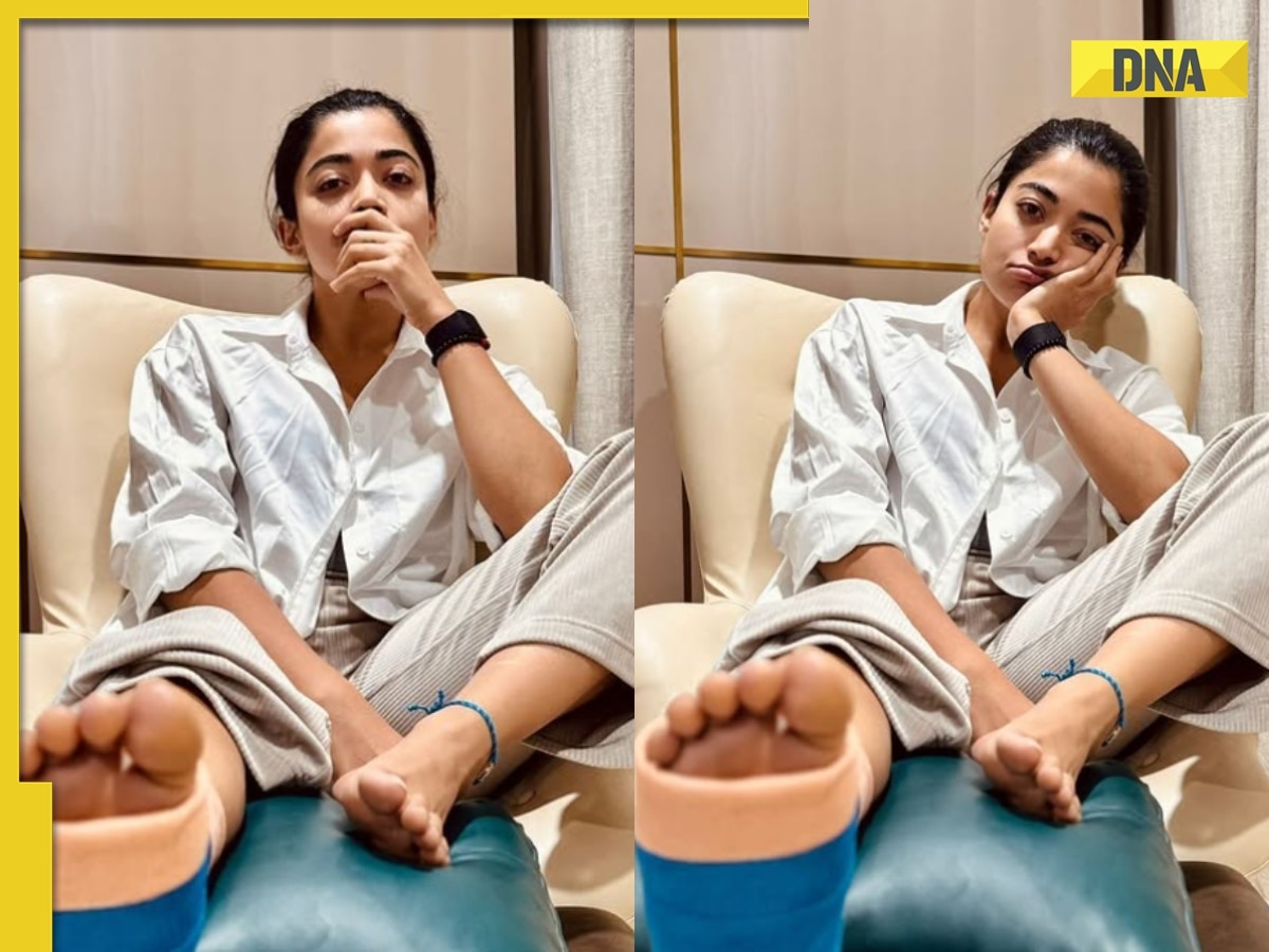 Rashmika Mandanna shares health update after leg injury, apologises to her directors: 'If you need me...'