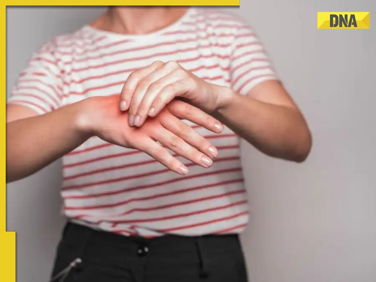 Guillain-Barre Syndrome cases surge in Pune: Know its causes, symptoms and more