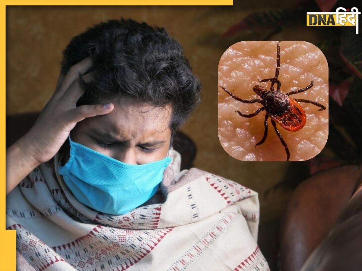 गुजरात में Congo Fever से एक की मौत, स्वास्थ्य विभाग अलर्ट, जानें क्या है ये बीमारी? 