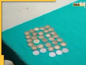 इस बीमारी का शिकार आदमी खाने लगता है सिक्के, डॉक्टर ने ऑपरेशन कर निकाले 33 Coins