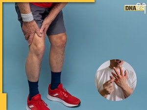 Uric Acid Remedies: जोड़ों में जमा यूरिक एसिड का खात्मा कर देंगी ये 5 आदतें, नहीं होगी सूजन और दर्द की समस्या
