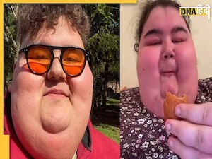 मोटापे की वजह से 24 साल के इंफ्लुएंसर की मौत, ज्यादा खाना खाने से फटा पेट, YouTube पर शेयर किया था आखिरी वीडियो