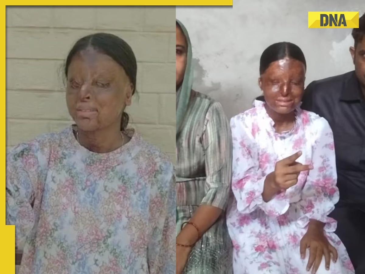 Meet Kafi, a 17-year-old acid attack survivor who lost her eyesight, yet secured 95.6 per cent in Class 12 exam, dreams of...