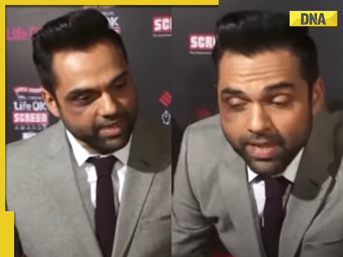 'Maar kha ke aa raha hun': When Abhay Deol attended award show with bruised eye, revealed being smacked by...