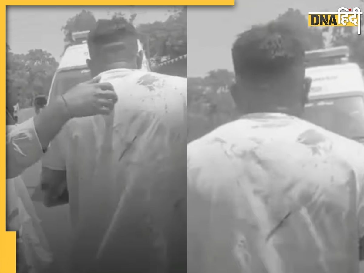 Air India Plane Crash: अहमदाबाद प्लेन हादसे में जीवित बचने वाले का पहला वीडियो आया सामने, लंगड़ाते हुए चल रहा है युवक