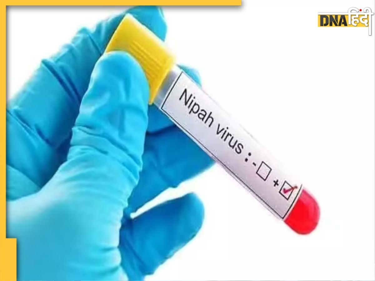 Nipah Virus Outbreak: निपाह वायरस से केरल में 345 बीमार, एक की मौत, जानिए जोनोटो बीमारी का पहला लक्षण क्या है?