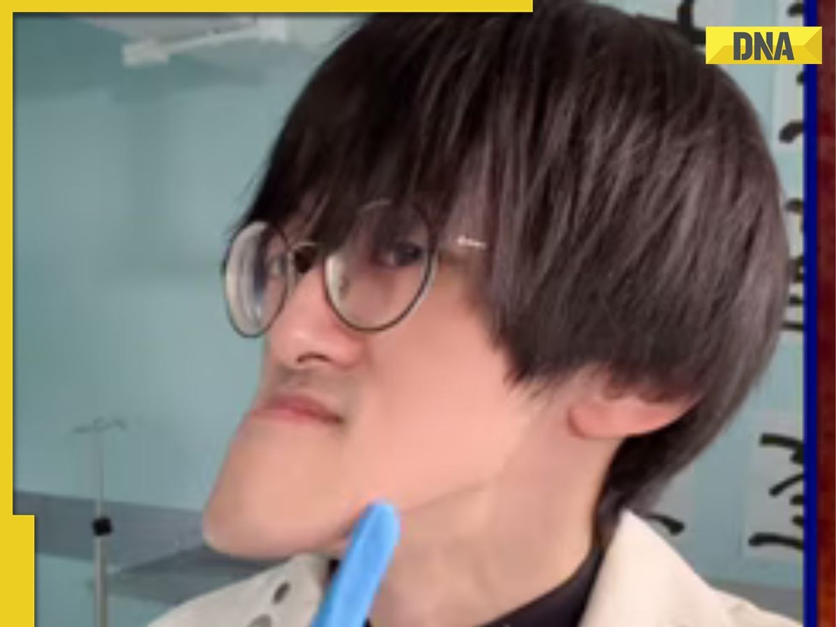 This man is ‘world’s longest-chinned YouTuber’, resembles this anime character, he faced rejection in..., is from... 