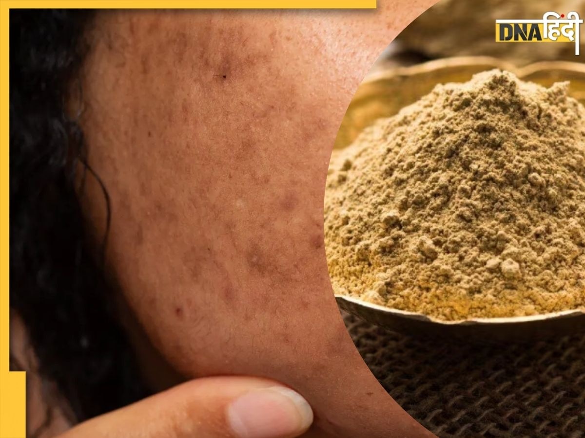 Multani Mitti for Dark Spots: चेहरे के काले दाग-धब्बे हटाने के लिए इस्तेमाल करें मुल्तानी मिट्टी, मिलेगी बेदाग और निखरी त्वचा