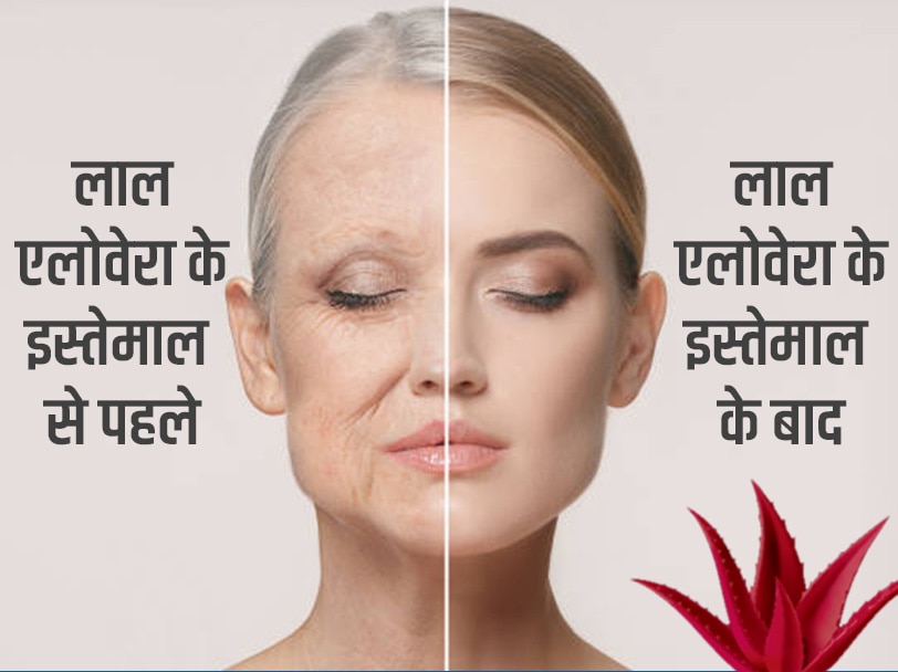 red aloevera removes wrinkles 