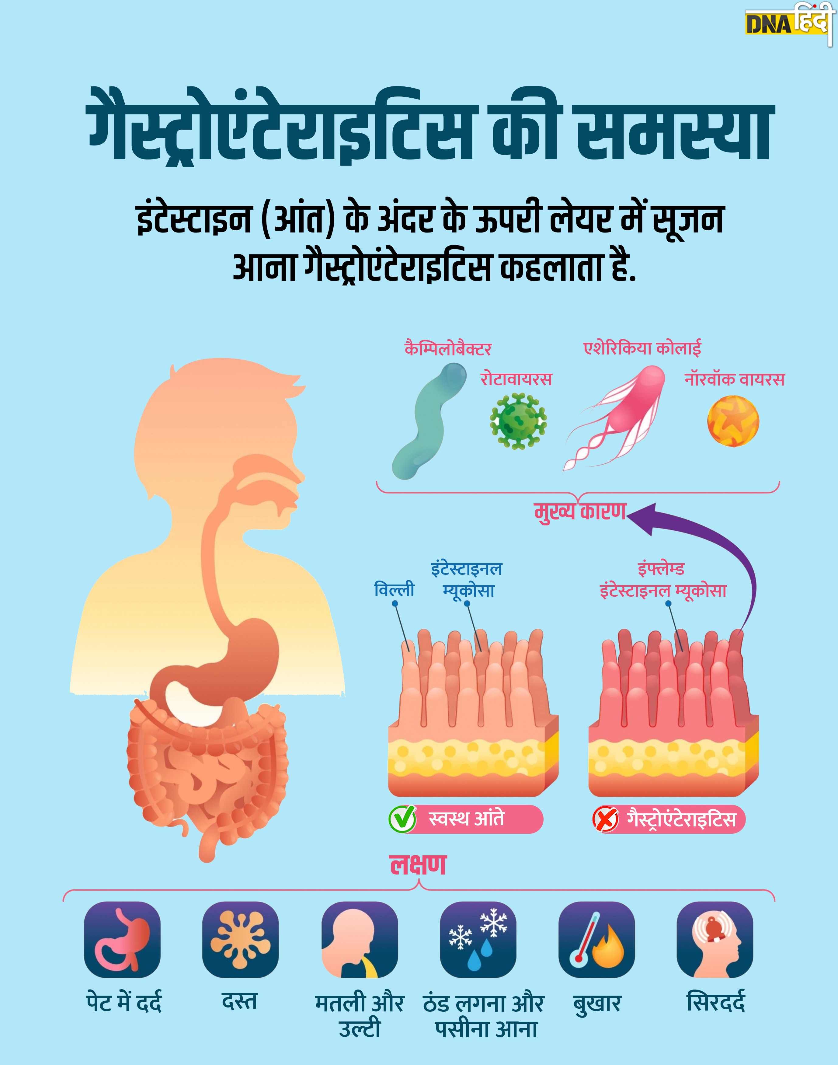 symptoms, causes, treatment, prevention of stomach flu or gastroenteritis