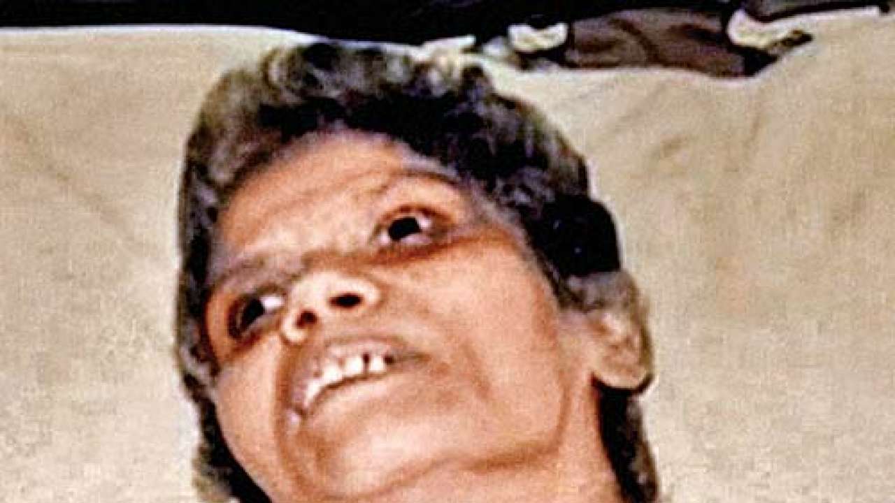 Aruna Shanbaug now stable but continues to be in ICU