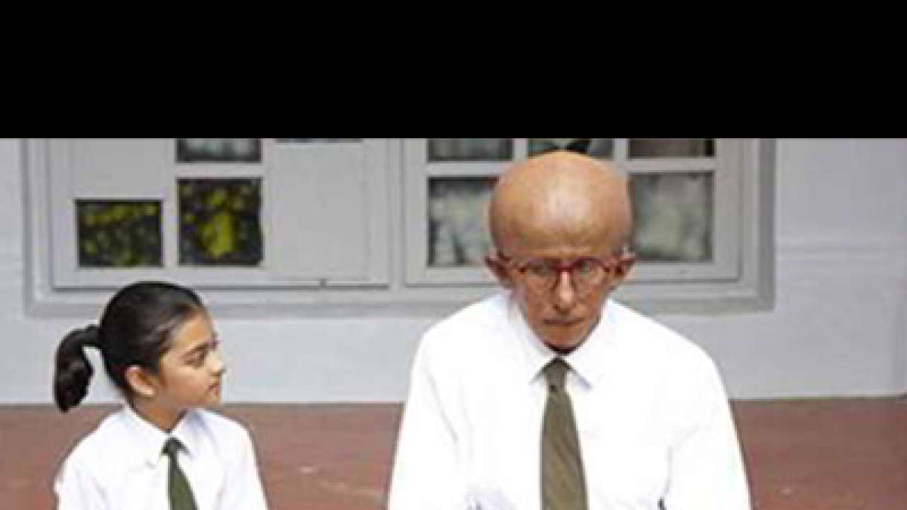 Ten weird diseases that will shock you