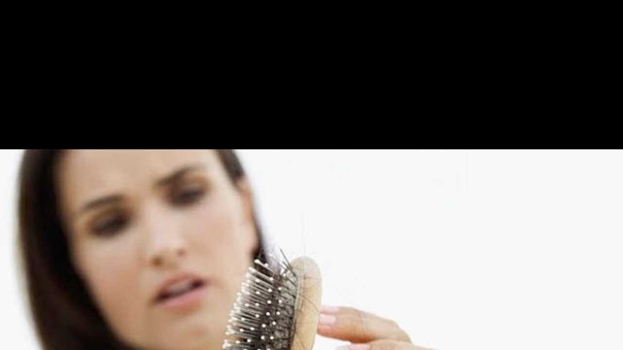 Top 10 reasons for hair loss in women Top 10 reasons for hair loss in women