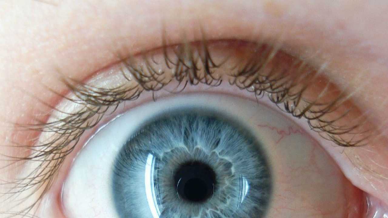 Now, turn your brown eyes blue with new laser technique