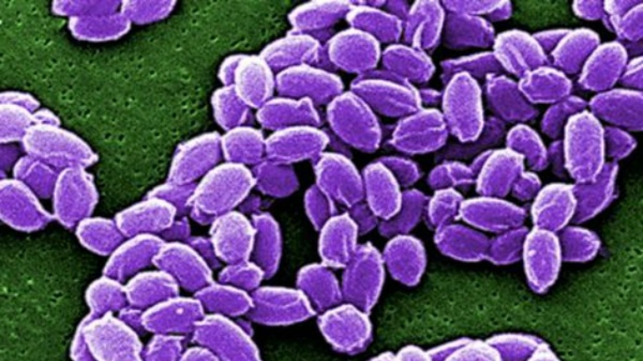 US lab's suspect anthrax may have been sent to Pentagon