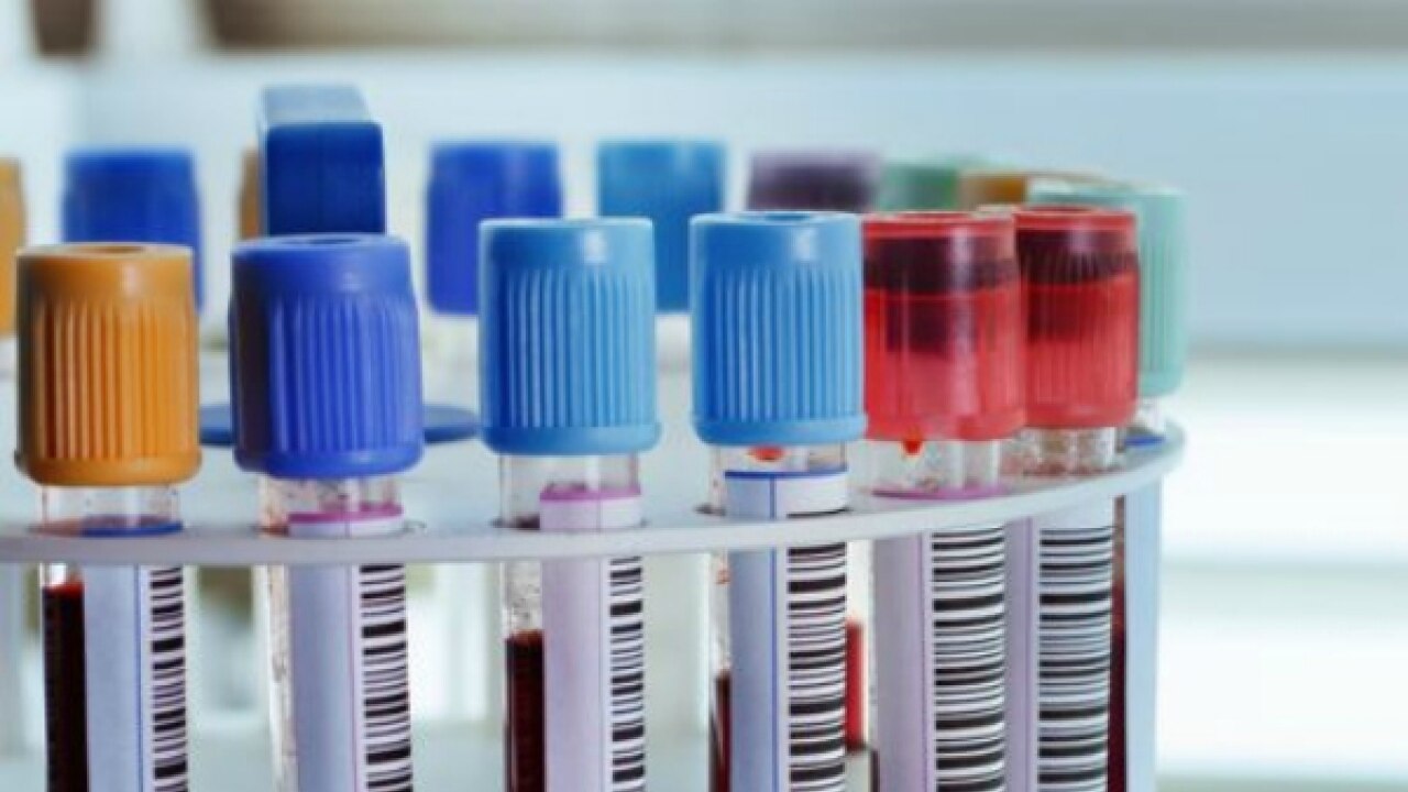 Specific levels of low vitamin D linked to heart troubles