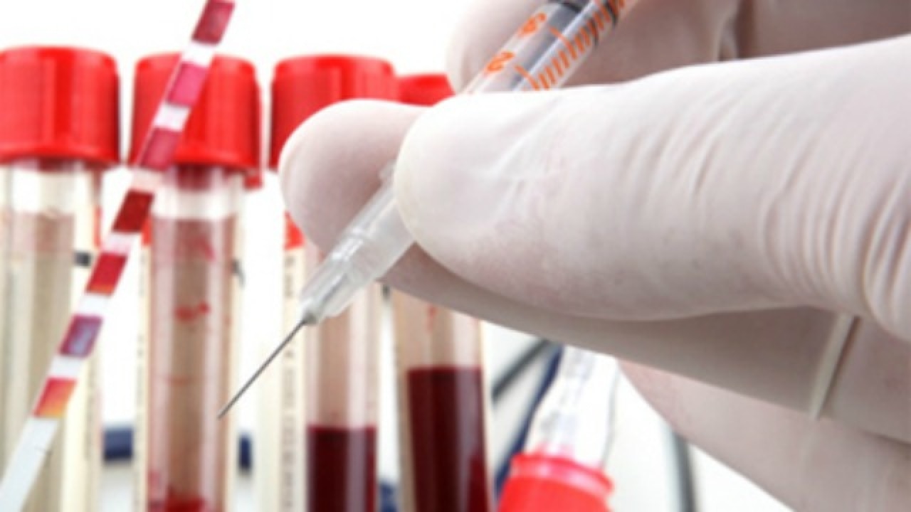 US FDA overturns 30year ban on blood donations by gay men