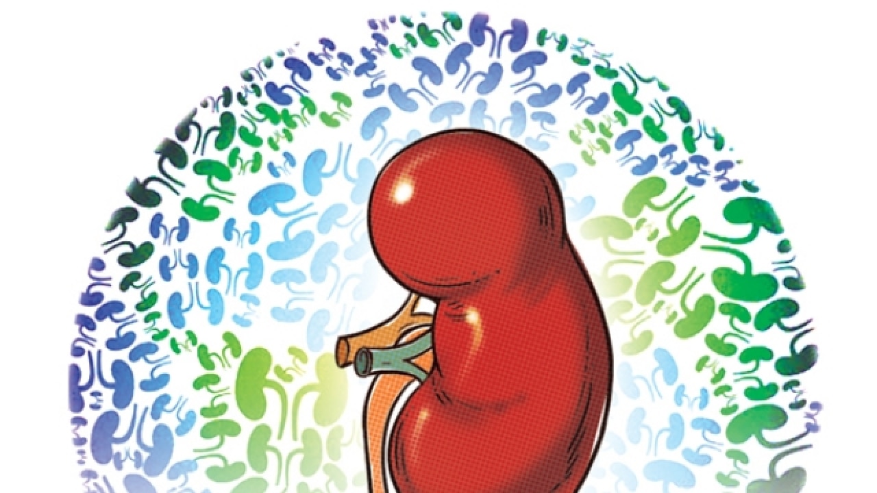 kidney transplant clipart