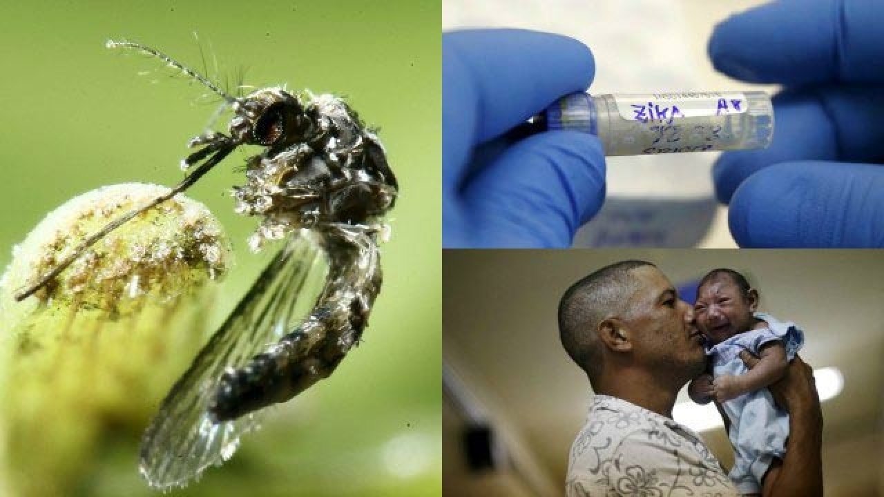 Zika Virus Alarm Grows Amid Us Sex Link Rising Birth Defects In Brazil 6114