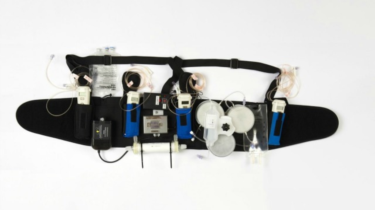 wearable-artificial-kidney-may-replace-dialysis
