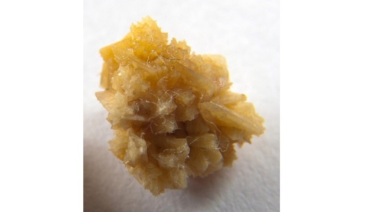 Prevent kidney stones with natural fruit extract