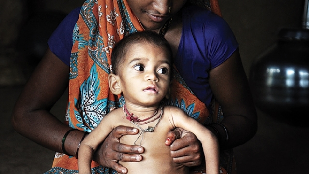 Maharashtra: Govt claims rise in death of tribal children, mothers not due to malnutrition