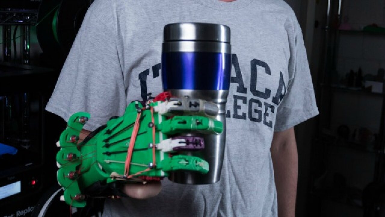 Watch 17 Year Old Student Builds Low Cost 3d Printed Prosthetic Hand