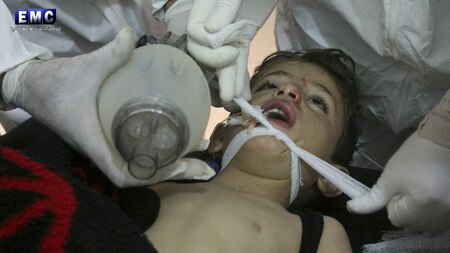 Syrian doctors treat a child