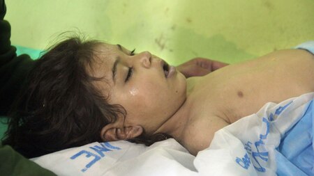 A Syrian child receives treatment
