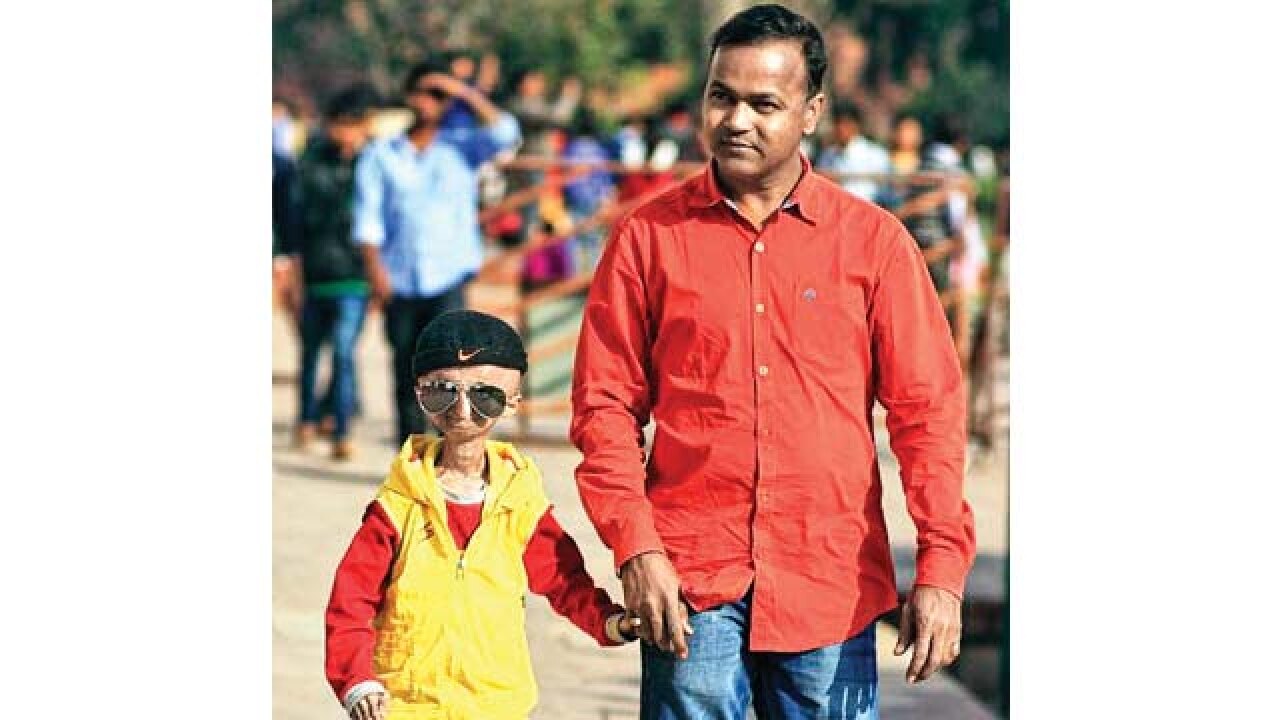 Progeria Campaign Mumbai Man On A Mission To Help Kids With Rare