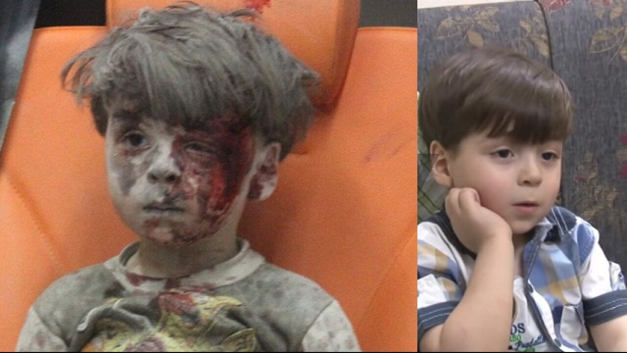 New images emerge of Syrian boy bloodied in iconic Aleppo 