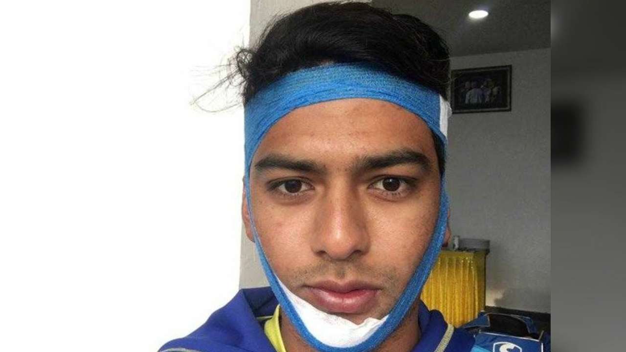 Vijay hazare trophy: unmukt chand does an anil kumble, slams century with broken jaw