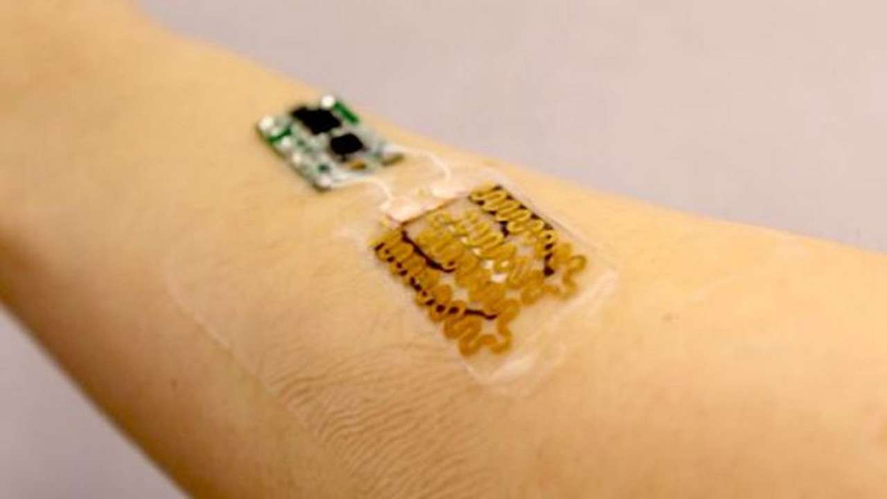 Novel smart bandages can monitor and treat chronic wounds