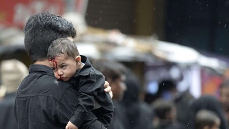 Muslim man carries his child after his forehead was cut