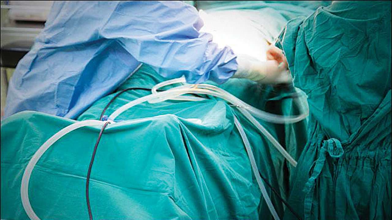 Surgery Surgery