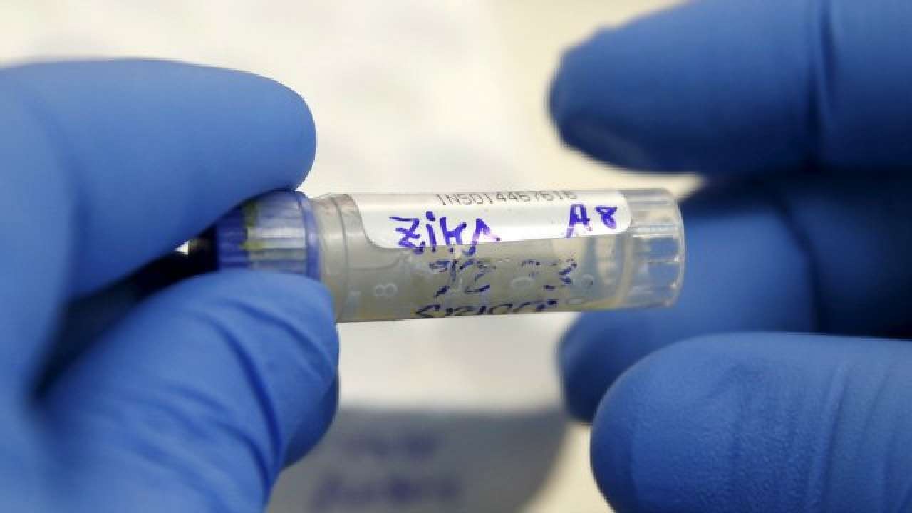 antibodies-for-zika