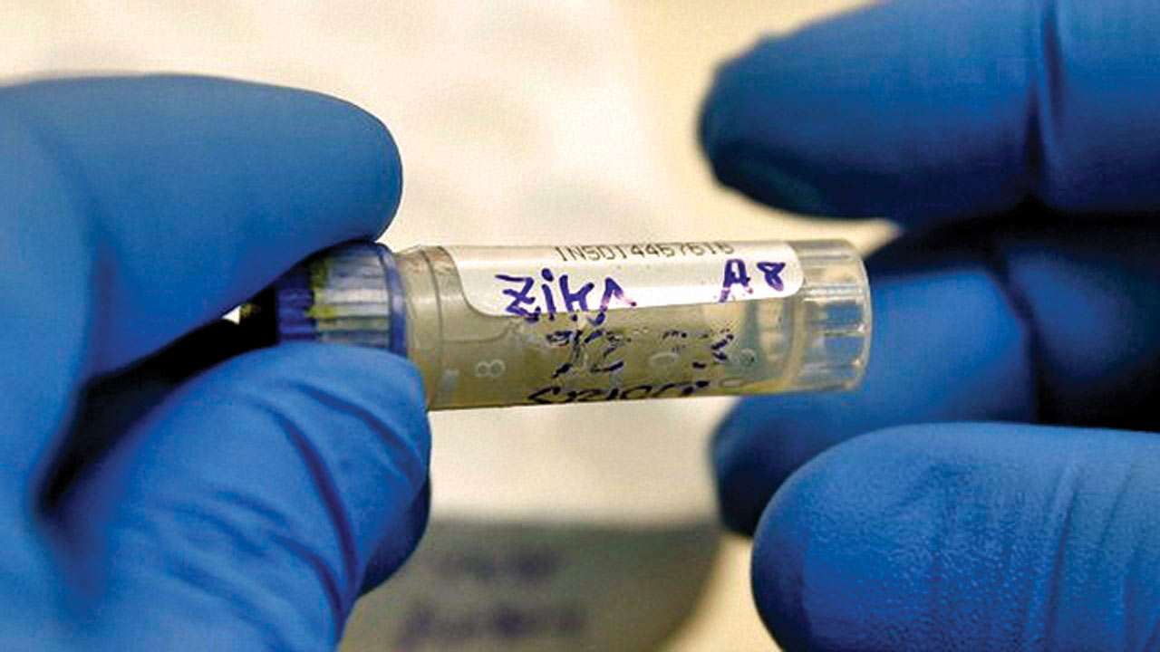 Zika virus