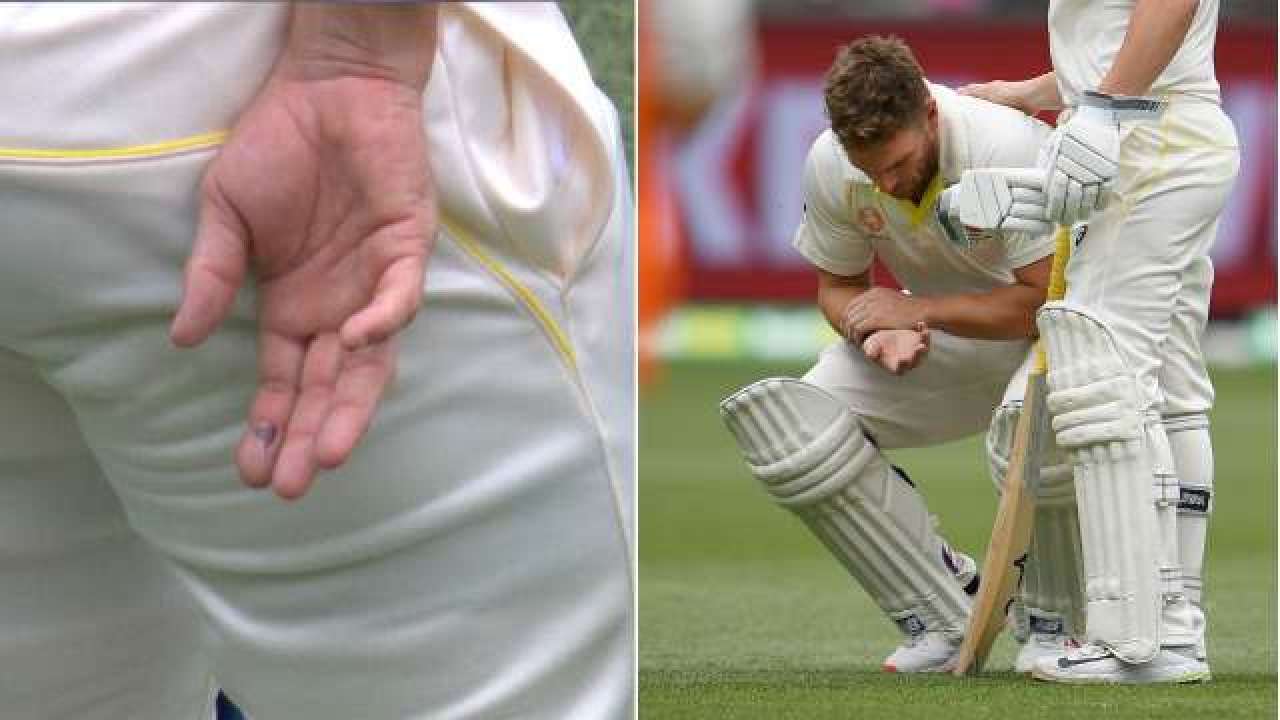 Aaron Finch cleared to bat