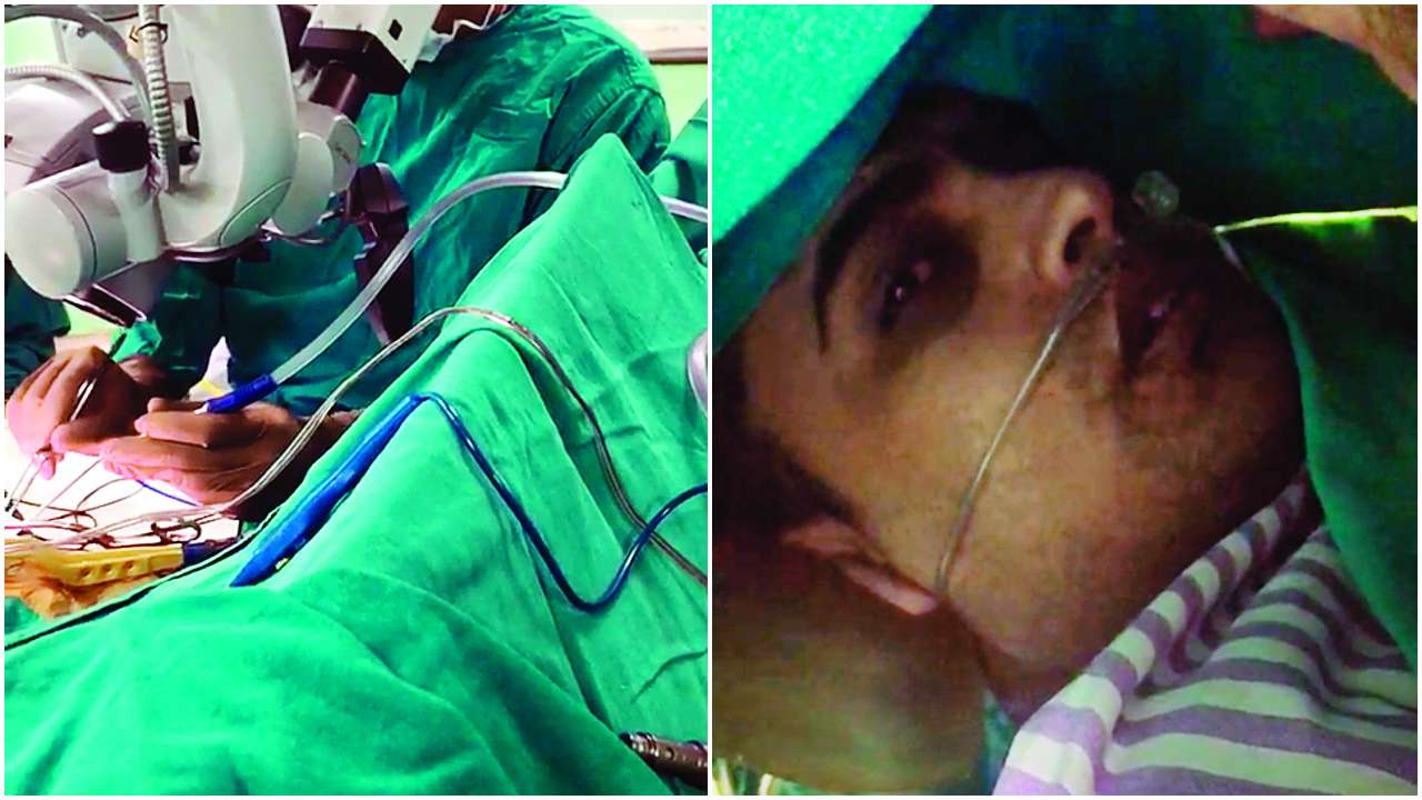 Rajasthan: Man reads paper as doctor removes his tumour